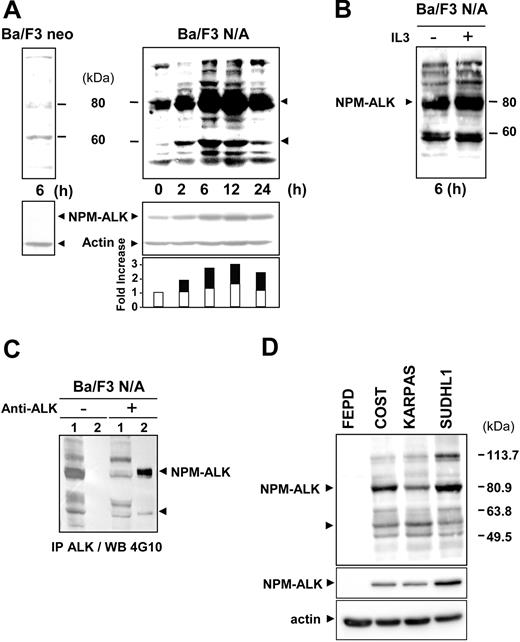 Figure 1. NPM-ALK tyrosine phosphorylation in Ba/F3 cells and ALCL-derived cell lines. (A) Ba/F3 neo and Ba/F3 N/A cells were deprived of serum for 24 hours, prior to serum restimulation for various times before cell lysis and immunoblot analysis with an antiphosphotyrosine antibody 4G10. The nitrocellulose membrane was stripped and reprobed with anti-ALK and antiactin antibodies to assess NPM-ALK expression and protein loading, respectively (middle panel). Band intensity was semiquantified by densitometric scanning of the film (actin: white; NPM-ALK: black). Protein extracts from 5 × 106 cells were loaded in each lane. (B) As a control, Ba/F3 N/A cells cultured with or without IL3 were used for immunoblotting with the 4G10 antibody. (C) For NPM-ALK immunodepletion experiments, Ba/F3 N/A cells were harvested 6 hours after serum restimulation and subjected to immunoprecipitation with or without the ALK1 antibody (1: supernatant; 2: beads) followed by immunoblotting with the 4G10 antibody. (D) NPM-ALK–negative (FEPD) and –positive (COST, KARPAS, and SU-DHL1) ALCL cell lines were maintained in normal culture conditions as described in “Materials and methods” prior to cell lysis and immunoblot analysis with the 4G10 antibody (upper panel) or with the anti-ALKc antibody (middle panel). The nitrocellulose membrane was stripped and reprobed with antiactin antibody to assess protein loading (lower panel). From cell protein extracts, 60 μg was loaded in each lane. Data shown in this figure are representative of 3 to 4 independent experiments.