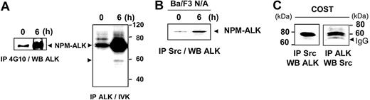 Figure 2. Interaction of an Src-kinase with NPM-ALK. (A) Ba/F3 N/A cells (107 cells per point) were harvested at 0 and 6 hours after serum restimulation and subjected to immunoprecipitation with the 4G10 antibody followed by immunoblotting with the ALKc antibody (left panel). The same cells were used for immunoprecipitation with the ALK1 antibody followed by in vitro kinase (IVK) assay (right panel). (B) Ba/F3 N/A cells (107 cells per point), at 0 and 6 hours after serum restimulation, were subjected to anti-Src immunoprecipitation using the Src-2 antibody followed by immunoblot analysis with the ALKc antibody. (C) ALCL-derived COST cells (107 cells per point) were subjected to anti-Src immunoprecipitation followed by immunoblotting using the ALKc antibody (left panel) or the way inverse (right panel). The position of IgG heavy chain is indicated.