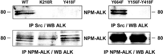 Figure 3. Implication of the kinase activity and the tyrosine 418 of NPM-ALK in its association with an Src-kinase. Jurkat cells stably expressing wild-type NPM-ALK or mutant forms of NPM-ALK were used to determine the tyrosine residue involved in NPM-ALK/Src-kinase association. Jurkat cells (107) expressing wild-type NPM-ALK (WT), kinase dead NPM-ALK (K210R), or Y418F, Y664F or the double Y156F-Y418F NPM-ALK mutants were subjected to anti-Src immunoprecipitation using the Src-2 antibody followed by immunoblotting using the ALKc antibody. The expression level of NPM-ALK WT, K210R, and Y418F mutants was comparable as well as the expression level of Y664F and Y156F-Y418F mutants (lower panels). Note that NPM-ALK is classically revealed as 2 to 3 distinct bands when expressed in Jurkat cells.15 Data shown are representative of 2 independent experiments with identical results.