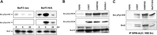 Figure 4. Activation of pp60c-src in NPM-ALK–expressing cells. (A) Ba/F3 neo and Ba/F3 N/A cells were subjected to the same serum deprivation/restimulation time course (24-hour serum withdrawal followed by 0-, 6-, and 24-hour serum readdition). Immunoblotting analysis of protein extracts (from 5 × 105 cells) was performed using anti-Src pTyr418 (signature of maximal activation of all Src-kinases), Src pTyr215 antibodies (specific for the activated form of pp60c-src), and anti-Src2 antibody (to visualize Src-family members). (B) Activation of Src-kinases was also revealed using the same antibodies in 4 ALCL-derived cell lines: FEPD (NPM-ALK negative), COST, KARPAS, and SU-DHL1 (NPM-ALK positive). Loaded per lane was 60 μg cell protein extracts. (C) NPM-ALK was immunoprecipitated (from 5 × 106 cells) with the ALK1 antibody followed by immunoblotting using the anti-Src pTyr418 antibody to analyze the activation state of the associated Src-kinases. The same nitrocellulose was stripped and reprobed using anti-Src2 antibody to visualize Src-family members. In panels A-B, proteins were separated on a 7.5% SDS-PAGE, whereas a 12% SDS-PAGE was used in panel C to achieve a higher resolution. Data shown are representative of 3 independent experiments with similar results.