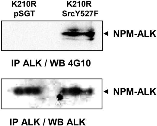 Figure 6. Phosphorylation of NPM-ALK by pp60c-src. Jurkat cells stably expressing the K210R kinase dead NPM-ALK mutant were transiently transfected with pSGT empty vector (lane 1) or pSGT SrcY527F hyperactive form of pp60c-src. At 48 hours after transfection, cells were subjected to immunoprecipitation with the ALK1 antibody followed by immunoblot analysis with the antiphosphotyrosine 4G10 antibody. Data shown are representative of 2 independent experiments with identical results.
