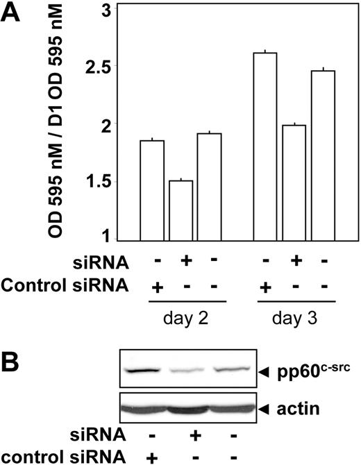 Figure 10. Involvement of pp60c-src on the proliferation of a patient-derived ALCL cell line. The ALCL cell line KARPAS was transfected or not by a specific pp60c-src siRNA or a control siRNA and seeded at 3 × 104 cells per well in a 96-well plate. At 24 hours after transfection, cell proliferation was determined each day for 2 days using an MTT proliferation assay. Reported results are mean ± SEM of at least 4 experiments. The decrease in proliferation rate observed in the presence of pp60c-src siRNA compared with control siRNA or untransfected cells was significant according to Student t test (P < .01). The expression level of pp60c-src and actin was assessed by immunoblotting 48 hours after transfection.