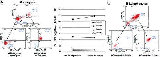 Figure 1. Isolation of GPI-anchored protein–negative (PNH) and GPI-anchored protein–positive (normal) B cells and monocytes. Mononuclear cells were collected by apheresis from PNH patients prior to transplantation. (A) Monocytes were sorted by flow cytometry into GPI-negative (CD64+/CD14–/CD59–) and GPI-positive (CD64+/CD14+/CD59+) populations using CD64 (non-GPI–anchored protein) to gate on monocytes and CD14 and CD59 as markers for GPI-anchored proteins. (B) B lymphocytes were expanded from pretransplantation apheresis samples using CD40 ligand–transfected NIH3T3 cells. The percentage of GPI-negative and GPI-positive B cells were similar in expanded versus nonexpanded samples. (C) After expansion, cells were flow sorted into GPI-negative (CD19+/CD55–/CD59–) and GPI-positive (CD19+/CD55+/CD59+) B lymphocytes using CD19 (non-GPI–anchored protein) to identify B cells and CD55 and CD59 as markers for GPI-anchored proteins.