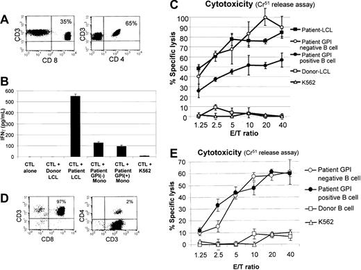 Figure 4. Recognition of GPI-positive (normal) and GPI-negative (PNH) cells by allogeneic mHa-reactive T-cell lines. The mHa-specific CTLs were expanded from posttransplantation PBMCs of patient nos. 3 and 5. (A) The mHa-reactive CTLs expanded from patient no. 3 contained a mixture of CD4+ and CD8+ T cells. (B) These CTLs showed similar recognition of GPI-negative and GPI-positive monocytes (mono) as determined by an ELISA measuring IFN-γ secretion. (C) At multiple effector-target (E/T) ratios, a slightly higher percentage of GPI-negative (CD19+/CD55–/CD59–) compared with GPI-positive (CD19+/CD55+/CD59+) B cells were killed by these CTLs. (D) The mHa-reactive CTLs expanded from patient no. 5 contained predominantly CD8+ T cells. (E) Similar levels of cytotoxicity of GPI-negative and GPI-positive B cells were observed. Error bars represent 1 standard deviation.