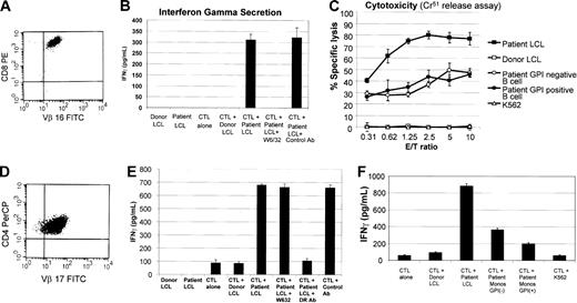 Figure 5. In vitro assessment of PNH cell sensitivity to mHa-specific CD8+ or CD4+ T-cell clones. mHa-reactive T-cell clones were tested for differences in their ability to recognize and/or kill GPI-anchored protein–positive (normal) versus GPI-anchored protein–negative (PNH) cells. (A) A CD3+/CD8+ T-cell clone expressing a single T-cell receptor (TCR Vβ-16, determined by flow cytometry) was expanded with a cytokine profile (B) compatible with MHC class I–restricted recognition of a patient-specific mHa. (C) This clone was cytotoxic to patient but not donor EBV-LCLs and killed GPI-negative (CD19+/CD55–/CD59–) B cells in a similar fashion as GPI-positive (CD19+/CD55+/CD59+) B cells. (D) A CD4+ T-cell clone that expressed a single T-cell receptor (TCR Vβ-17) was isolated by limiting dilution from the same mHa-reactive CTL line and secreted IFN-γ against recipient but not donor EBV-LCLs, confirming patient-specific mHa recognition. (E) A decrease in IFN-γ when patient EBV-LCLs were precultured with an HLA-DR blocking antibody was consistent with T-cell antigen recognition within the context of MHC class II. (F) This CD4+ T-cell clone secreted a slightly higher amount of IFN-γ when cocultured with GPI-negative (CD64+/CD14–/CD59–) compared with GPI-positive (CD64+/CD14+/CD59+) patient monocytes. Error bars represent 1 standard deviation.