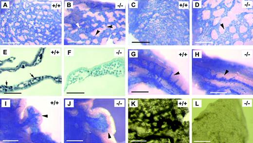 Figure 1. Csk–/– embryos display branching defects during vascular development. (A-B) X-gal–stained yolk sac membranes from Csk+/+, Flk-1+/– and Csk–/–, Flk-1+/– embryos at E8.2. Black arrowheads in panel B show examples of unsuccessful sprouting. Note that blood vessels in panel B are, in general, larger than those in panel A. White arrowhead points to a large vessel. To ensure that the observed defects in Csk–/–, Flk-1+/– embryos were not due to Flk-1+/– heterozygosity, immunohistochemical (IHC) staining was also performed with anti–Flk-1 monoclonal antibody (BD-Pharmingen, San Diego, CA) on Csk+/+ and Csk–/– embryos resulting from Csk+/– × Csk+/– mating. Furthermore, Csk+/– mice were also crossed with Flt-1+/– mice to label endothelial cells with a different marker. Results from these experiments (not shown) were consistent with those shown in this figure. (C-D) Yolk sac membranes from E8.5 embryos. Note Csk–/– yolk sacs have fewer but larger blood vessels than the healthy control. Arrowhead points to one blood vessel with increased caliber. (E-F) Paraffin sections of anti-Csk–stained yolk sacs. These 2 panels illustrate 2 points: (1) vascular lumens are enlarged in Csk–/– yolk sacs; and (2) Csk is expressed in endothelial cells (arrows in E). (G-H) E8.5 embryo proper, showing dorsal aortae and intersomitic vessels (arrowhead). In the mutant, intersomitic vessels do not successfully sprout from the dorsal aortae. The arrowhead in panel H indicates unsuccessful sprouting. (I-J) show the ventricle of E8.5 embryos. In healthy embryos (I), ventricular endocardium (blue) form branches (arrowhead). In Csk–/– mutant, the endocardium (blue staining pointed by arrowhead) does not branch. (K-L) Whole mount, anti-Csk IHC-stained yolk sac membranes. Sections shown in panels E and F were derived from K and L, respectively. Bars in panels A-D and G-L represent 200 μm; bars in panels E-F represent 50 μm.