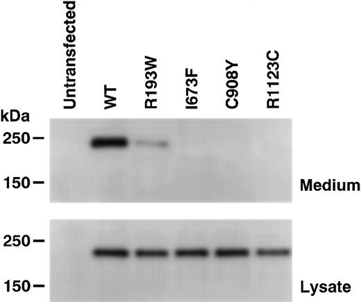Figure 2. Expression of rADAMTS13. The wild-type (WT) rADAMTS13 and mutants with C-terminal FLAG-tag were transiently expressed in HeLa cells. The culture media (top) and cell lysates (bottom) were analyzed by Western blotting with an anti-FLAG antibody. The sizes of protein standards are indicated at the left.