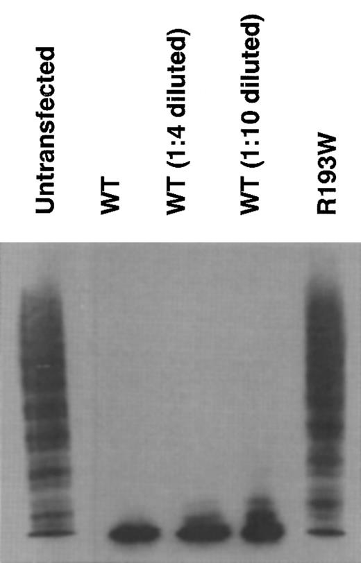 Figure 3. Cleavage of VWF multimer by rADAMTS13. The rADAMTS13 activity was measured by degradation of VWF multimers. The culture media of untransfected, WT, and the R193W mutant were incubated with purified VWF. The multimeric state of VWF was determined by Western blot analysis after SDS–agarose gel electrophoresis. The 1:4 diluted WT medium contained the enzyme amount roughly equivalent to the medium of the R193W mutant.