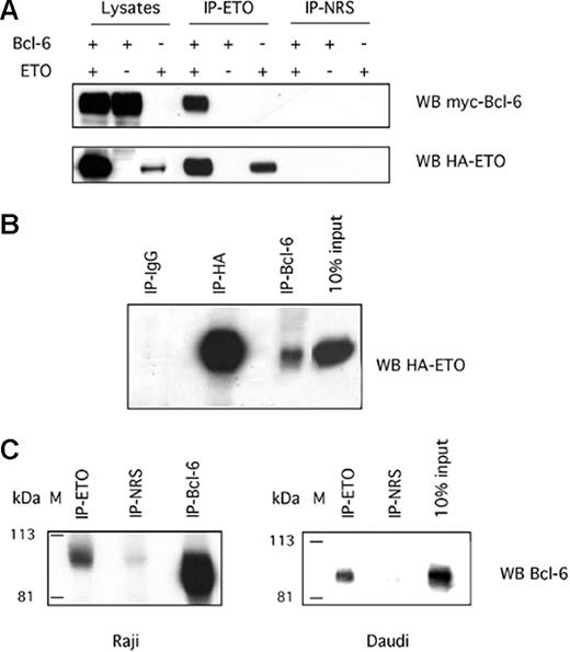 Figure 2. ETO interacts with Bcl-6 in vivo. (A) 293T cells were transfected with HA-ETO, myc-Bcl-6 plasmid, or the respective empty vectors. Whole-cell lysates were immunoprecipitated with an ETO-N-terminal polyclonal antibody or normal rabbit serum (NRS) as a negative control and immunoblotted for myc to visualize the Bcl-6 ETO expression (upper panel) or for HA to verify ETO expression (lower panel). (B) Reciprocal immunoprecipitation in similarly transfected 293T cells in which control IgG, HA, or myc (to myc-Bcl-6) antibodies were used to pull down HA-ETO. (C) Whole-cell lysates from Raji cells (left) or Daudi cells (right) were subjected to immunoprecipitation of endogenous ETO with an N-terminal polyclonal antibody or rabbit serum control (NRS) and were subsequently immunoblotted for endogenous Bcl-6 with a mouse monoclonal antibody.
