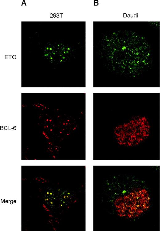 Figure 3. ETO colocalizes with Bcl-6 in vivo. (A) 293T cells were cotransfected with levels of ETO and Bcl-6 that reproduce the endogenous nuclear staining pattern of both proteins. Immunofluorescence visualization was achieved by exposing the cells to ETO polyclonal antibody and Bcl-6 monoclonal antibody, followed by Alexa 488 (green)– and Alexa 568 (red)–labeled secondary antibodies, respectively. Cell sections were visualized at × 60 magnification using laser scanning confocal microscopy. Panels show the visualization of ETO or Bcl-6 alone and the overlay of both images in the lower panel. (B) Daudi cells were treated with the same antibodies to detect localization of endogenous ETO and Bcl-6 by immunofluorescence. Cell sections were visualized by confocal microscopy at × 60 magnification, as described for panel A.