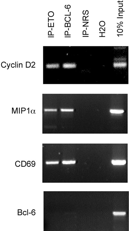 Figure 7. ETO and Bcl-6 are present at the promoters of endogenous Bcl-6 target genes in B cells. Chromatin immunoprecipitations were performed on Daudi cells for endogenous proteins with either rabbit N-terminal ETO antibody, rabbit polyclonal Bcl-6 antibody, or rabbit IgG control. ChIP products were PCR amplified using primers surrounding the Bcl-6 binding site on the cyclin D2, CD69, and MIP1α promoters. DNA input as positive control and H2O as negative control are also shown. A control PCR reaction with primers from within ORF of Bcl-6 was also performed as a negative control.