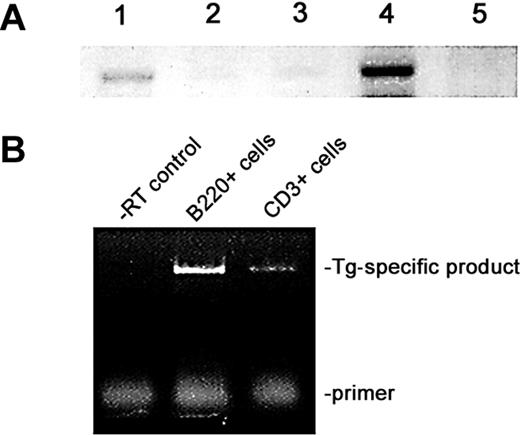 Figure 1. Expression of transgene in lymphoid tissues. (A) RT-PCR analysis of Eμ-BRD2 expression in different Tg tissues. Lane 1, non-Tg spleen control; lane 2, Tg heart control; lane 3, Tg skeletal muscle control; lane 4, Tg spleen; lane 5, Tg thymus. Primers amplified both endogenous murine message and Tg message. Negative controls without RT verified the RT dependence of the signal (results not shown). (B) Tg expression in Tg B and T cells. The 5′ primer recognizes a Tg vector–specific sequence at the translation start site and the 3′ primer a sequence within the first bromodomain, common to both endogenous and Tg sequences. Analysis was performed with purified B-cell RNA (B220) and T-cell RNA (CD3). Control reaction without reverse transcriptase is shown (–RT control).