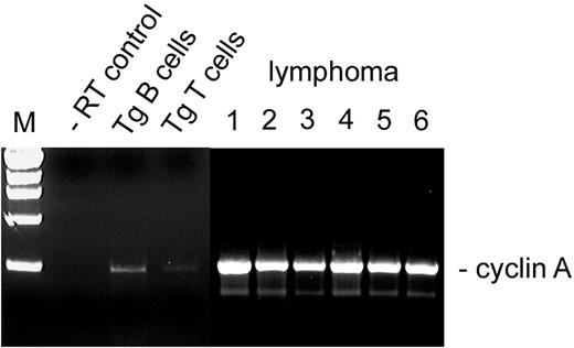 Figure 7. Cyclin A expression in Tg B-cell malignancy. RT-PCR was performed with RNA from purified B cells (Tg B cells) or purified T cells (Tg T cells) from spleens of asymptomatic Tg mice, using primers to the cyclin A gene. Results were compared with negative control (–RT) and to RNA from B cells obtained from independently arising B-cell lymphomas in 6 different mice. Lymphoma lane 1, Tg leukemic mouse (transplant donor); lane 2, Tgmut leukemic mouse; lane 3, second serial transplantation; lane 4, second serial transplantation; lane 5, fourth serial transplantation; lane 6, fourth serial transplantation.