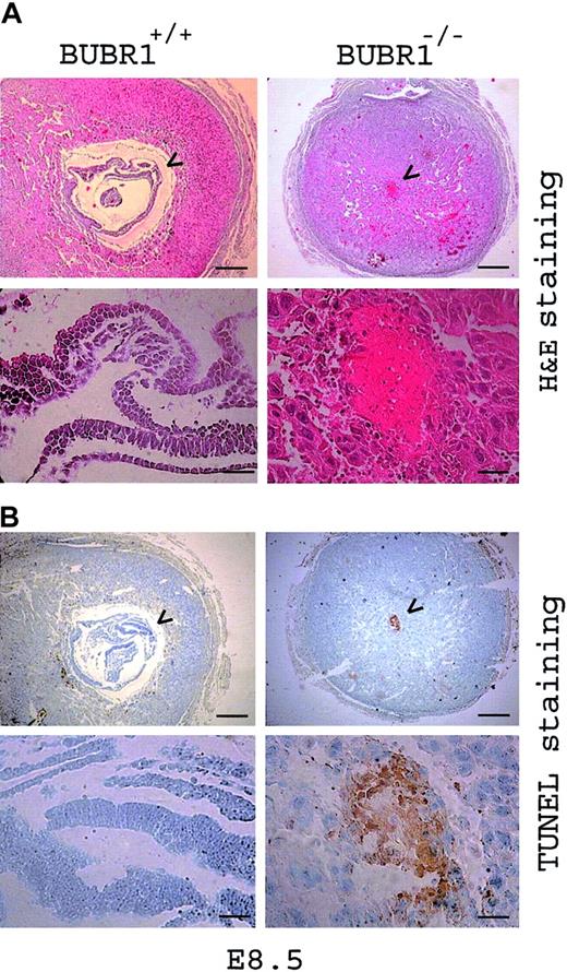 Figure 3. Cause of death for BUBR1-null embryos. BUBR1-null embryos die of apoptosis. Postimplantation mouse embryos at E8.5 were fixed, embedded in paraffin, and sectioned transversely. Neighboring sections were either stained with hematoxylin-eosin (panel A) or subjected to the TUNEL technique (panel B), and were then examined at low (scale bar = 0.2 μm) and high (scale bar = 5 nm) magnification (upper and lower panels, respectively). Arrowheads indicate embryos or embryonic remnants. Attempts to confirm the genotypes of the abnormally developed or resorbed embryos were rendered difficult by contamination of tissue from the mother. The BUBR1–/– designation of the embryo shown was thus presumed. Gross morphologic examination, however, demonstrated that about one fourth of the embryos resulting from BUBR1+/– intercrosses either developed abnormally or were resorbed (Table 1) and that atrophic embryos were rarely observed to result from intercrosses of wild-type animals, thus supporting the presumptive genotyping.
