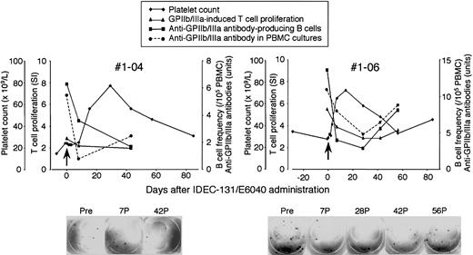 Figure 5. Platelet count and T- and B-cell responses to GPIIb/IIIa during the course of IDEC-131/E6040 treatment in representative responders in the 10 mg/kg group. Platelet count, anti-GPIIb/IIIa antibody-producing B-cell frequency, GPIIb/IIIa-induced T-cell proliferation, and antigen-dependent anti-GPIIb/IIIa antibody production in PBMC cultures were evaluated at the indicated time points. Arrows denote the day of drug infusion (day 0). The lower panel shows representative images from the enzyme-linked immunospot assay for the detection of anti-GPIIb/IIIa antibody-producing B cells. Pre, pretreatment (day 0); 7P, 28P, 42P, and 56P, days 7, 28, 42, and 56 after treatment.