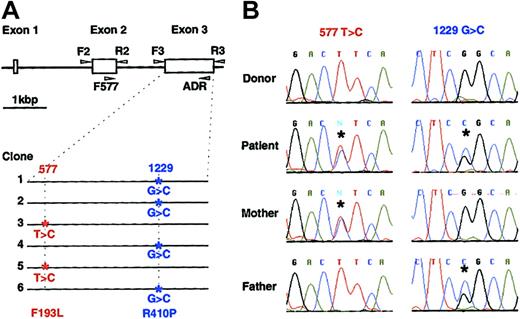 Figure 3. Perforin mutations in the patient with CAEBV and in his parents. (A) The perforin gene contains 3 exons and the open reading frame is encoded by the second and third exons. Exons 2 and 3 were amplified by PCR from genomic DNA using the indicated primers (arrowheads),20 cloned in plasmid pCR2.1, and sequenced. Mutations were found in both alleles of exon 3 in the patient. Four of 6 clones had a G to C mutation at nucleotide 1229 and 2 clones had a T to C mutation at nucleotide 577, indicating that each allele had a separate mutation. (B) Chromatograms of RT-PCR products. RT-PCR was performed using mRNA isolated from stimulated PBMCs of the patient, his parents, and a healthy donor. RT-PCR products were directly sequenced (not having been cloned) and asterisks indicate mutations.