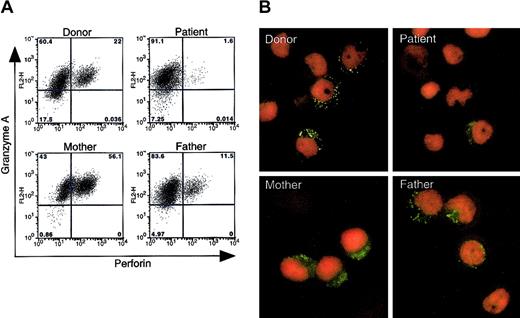 Figure 4. Expression of the native form of perforin in stimulated PBMCs from the patient, his parents, and a healthy blood bank donor. (A) PHA- and IL-2–stimulated PBMCs were fixed and permeabilized, stained with FITC-conjugated antiperforin antibody (dG9; Ancell, Bayport, MN) or phycoerythrin (PE)–conjugated anti–granzyme A antibody (CB9; BD Pharmingen), and analyzed by flow cytometry. The experiment was performed 3 times with similar results. The normal range of perforin-positive cells in 3 healthy donors was 3.4% to 56% (average 14%) in 4 separate experiments. (B) Immunofluorescence assay shows expression of perforin in PBMCs stimulated with PHA and IL-2, fixed, permeabilized, incubated with FITC-conjugated antiperforin antibody dG9 (green), and counterstained with propidium iodide (red). Original magnification, × 1000.
