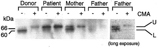 Figure 5. Inhibition of proteolytic cleavage of perforin in the patient with CAEBV. Stimulated PBMCs were cultured in the presence (+) or absence (–) of 200 nM concanamycin A (CMA) for 5 hours. Lysates were prepared from the cells and perforin was detected by immunoblotting with 2d4-perf antibody under nonreducing conditions.29,30 Two bands corresponding to perforin are seen. The upper (U) and lower (L) bands indicate precursor and mature form of perforin, respectively. Protein concentrations were equal in each sample. The right panel indicates a darker exposure from a repeat experiment using the father's cells.