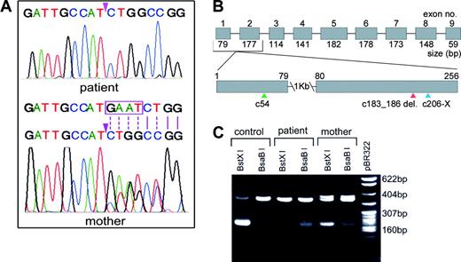 Figure 2. Analysis of PCR-amplified exon 2 from genomic DNA. (A) Nucleotide sequence of the region with the GAAT 4-base deletion (beginning at the arrowhead) in the patient (upper panel) who is homozygous, and the corresponding region in the mother (lower panel) who is heterozygous for this deletion. The normal sequence in one allele in the mother is shown in the upper strand, and the boxed sequence in this strand is shown as deleted in the lower strand to depict the mutated allele. Note the overlapping peaks past the deletion because of dissimilar bases (indicated by broken lines) and single peaks because of identical bases (indicated by solid lines), representing one normal allele and one mutated allele in the mother. (B) Schematic representation of the IF gene (approximately 20 kb). The boxed segments represent the 9 exons (1251 bp). The region with the deletion is enlarged to show the signal peptide cleavage site (c54, green arrowhead), the location of the deletion (c183_186delGAAT, red arrowhead), and termination of translation (c206-X, blue arrowhead). (C) Restriction enzyme digestion of the PCR-amplified fragment with BstXI and BsaBI. The control has a single site for BstXI and does not cut with BsaBI; the homozygous patient has lost the site for BstXI because of the 4-base deletion which resulted in a site for BsaBI; the mother who is heterozygous shows sites for both restriction enzymes, and the heteroduplex in the uncut DNA represents the 2 alleles.
