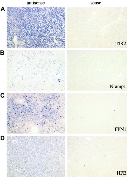 Figure 3. In situ hybridization analysis of TfR2, Nramp1, FPN1, and HFE. In situ hybridization analysis of TfR2 (panel A), Nramp1 (panel B), FPN1 (panel C), and HFE (panel D) genes in rat liver tissue. For each gene, the images from the analysis of both antisense and sense probes are shown. The former represent the gene-specific probe, while the latter are used as negative controls. Owing to the variations in expression levels of the examined genes, the incubation times for the last step of the procedure (BM purple color development) varied so that we could obtain optimal images. The incubation times for TfR2, Nramp1, and FPN1 were 48 hours. The incubation time for HFE was 72 hours. All images were taken under × 100 original magnification.