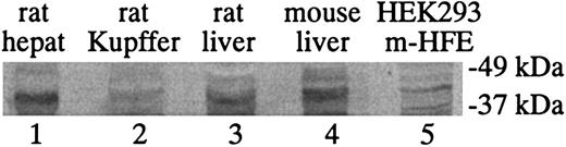 Figure 4. Western blot analysis of HFE protein expression levels. Western blot analysis of HFE protein expression levels in isolated rat hepatocytes (lane 1) and Kupffer cells (lane 2). Whole rat liver (lane 3), mouse liver (lane 4), and mouse HFE gene–transfected HEK 293 cells (HEK293 m-HFE, lane 5) were included as controls. Lysates (100 μg) were loaded into each lane except for lane 5, where 30 μg HEK293 m-HFE lysate was loaded.