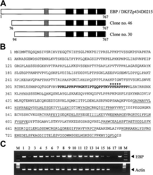 Figure 1. Structure and tissue expression of EBP. (A) Schematic representation of EBP. EBP encodes a protein of 767 amino acids and comprises a central proline-rich region (PRR) followed by 4 SH3 domains. The SH3 domains are indicated by black boxes, and the PRR is shown as hatched boxes. Clone nos. 30 and 46 were obtained from yeast 2-hybrid library screening. Reported sequence DKFZp434D0215 (GI: 27477709) that shows nucleotide sequence identity with EBP is aligned for comparison. (B) Deduced amino acid sequence of EBP. The PRR within amino acids 320-350 is boldfaced. Putative EEN-binding motif, PPERP in amino acids 343-347, is marked by asterisks. Four SH3 domains located in amino acids 473-529, 552-606, 639-696, and 708-765 are underlined. (C) Tissue expression of EBP. Analysis of EBP expression by PCR in multiple human adult (1-8) and fetal (9-16) tissue cDNAs. Arrowheads indicate specific PCR products amplified. PCR of actin is included as control. Heart (1,9), brain (2,10), placenta (3), lung (4,11), liver (5,12), skeletal muscle (6,13), kidney (7,14), pancreas (8), spleen (15), thymus (16), water (17), EBP plasmid DNA (18), 100-bp ladder marker (M).