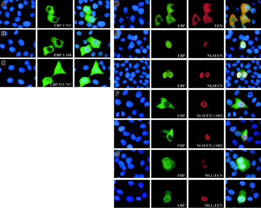 Figure 5. Expression of EEN and MLL-EEN relocate EBP. (A-C) Subcellular localization of Myc-tagged EBP 1-767, EBP 1-358, and EBP 532-767. (D) EEN and EBP colocalize in the cytoplasm. (E) NLSEEN interacts with and recruits EBP from the cytoplasm into the nucleus. (F) NLSEENΔSH3 mutant unable to relocate EBP into the nucleus. (G) MLL-EEN partially relocates EBP into the nucleus. HeLa cells were transiently transfected with Myc-tagged EBP with FLAG-tagged EEN or MLL-EEN. EBP and EEN/MLL-EEN were visualized by anti-Myc and anti-FLAG antibodies, followed by FITC-conjugated antirabbit and rhodamine-conjugated antimouse antibodies, respectively. Nucleus in each case was visualized by DAPI staining. Overlay of DAPI-, FITC-, and rhodamine-stained images are shown in the last column. Original magnification, × 1000.