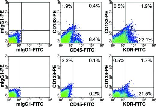 Figure 2. EPCs coexpressing CD133 and KDR in proliferating hemangiomas. Hematopoietic cells were removed from a single cell suspension prepared from proliferating hemangioma specimen 75 using anti-CD45 magnetic microbeads. Before (top) and after (bottom) depletion, cells were double-labeled with PE- or FITC-conjugated mouse antihuman isotype-matched IgG controls, or PE-conjugated anti-CD133 and FITC-conjugated anti-CD45, or PE-conjugated anti-CD133 and FITC-conjugated anti-KDR. Labeled cells were analyzed by flow cytometry and 20 000 events were acquired. Percentage of cell population expressing single or double markers are shown in each quadrant.