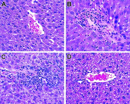 Figure 4. Histologic analysis of liver. T cells from unprimed C57BL/6 mice were transplanted into lethally irradiated BALB/c mice along with T cell–depleted bone marrow cells. Biopsies were obtained on day +26. Hematoxylin and eosin; original magnification × 100. (A) TCD BM only. (B) Unseparated. (C) CD62L+. (D) CD62–.