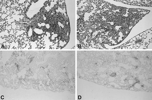 Figure 4. Similar pathological findings in lungs of Wt and TMpro/pro mice during Klebsiella pneumonia. Histologic sections of lungs of Wt (A) and TMpro/pro (B) mice 24 hours after inoculation with K pneumoniae (HE staining). Fibrin(ogen) immunostaining of lung 24 hours after inoculation with K pneumoniae in Wt (C) and TMpro/pro (D) mice. Original magnification, × 50. Representative slides are shown from a total of 5 mice per group.