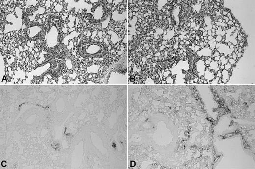 Figure 6. Similar pathological findings in LPS-induced lung inflammation in lungs of Wt and TMpro/pro mice. Histologic sections of lungs of Wt (A) and TMpro/pro (B) mice 6 hours after inoculation with LPS (HE staining). Fibrin(ogen) immunostaining of lung 6 hours after inoculation with LPS in Wt (C) and TMpro/pro (D) mice. Representative slides are shown from a total of 5 mice per group. Original magnification, × 50.