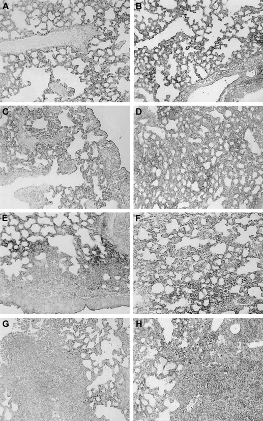 Figure 7. Reduced TM expression in areas of lung inflammation in Wt and TMpro/pro mice. Immunostaining for TM in the lungs of Wt (A) and TMpro/pro (B) mice, in lungs 6 hours after LPS administration in Wt (C) and TMpro/pro (D) mice, 24 hours after K pneumoniae in Wt (E) and TMpro/pro (F) mice, and 48 hours after S pneumoniae in Wt (G) and TMpro/pro (H) mice. Slides are representative for n = 5 for each group; magnification, × 20.