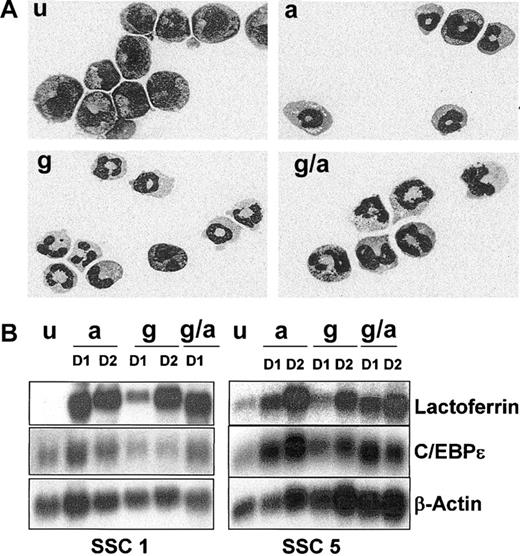 Figure 2. Neutrophil differentiation of EPRO-Gr cells. The effects of G-CSF (100 ng/mL) and/or ATRA (10 μM) on differentiation of EPRO-Gr was monitored by Wright-Giemsa stained cytospins and northern analysis. EPRO-Gr cells (u) were induced by the addition of ATRA (a), G-CSF-alone (g), or the combination of G-CSF plus ATRA (g/a). Cells were harvested daily. (A) Wright-Giemsa–stained cytospins were subjected to morphologic assessment by light microscopy. Shown are representative cells induced for 3 days as described above (original magnification, × 100). (B) Total RNA was isolated from EPRO-Gr cells induced as described above and subjected to Northern analysis. RNA was isolated from uninduced EPRO-Gr and cells induced for 24 hours (D1) and 48 hours (D2). Ten micrograms total RNA from each sample was analyzed by Northern blotting. Blots were sequentially probed with 32P-labeled cDNA probes for mouse lactoferrin and human C/EBPϵ. To monitor loading of RNA, the blot was probed with mouse β-actin.