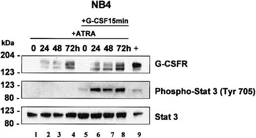 Figure 5. STAT3 analysis in NB4 cells. NB4 cells were induced with ATRA (5 μM) for 0, 24, 48, and 72 hours. At each time interval, a representative sample was treated with G-CSF (100 ng/mL) for 15 minutes. Total cell lysates (5 × 103 cells/μL2 × GSB) from cells induced with ATRA alone (lanes 1-4) or treated with ATRA with subsequent treatment with G-CSF (lanes 5-8) were harvested and subjected to Western blot analysis. The blot was sequentially probed for STAT3, phospho-STAT3 (Tyr 705), and human G-CSFR as outlined in “Materials and methods.” As a positive control, lysates from EML cells overexpressing human G-CSFR were run in parallel (lane 9).