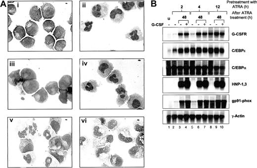 Figure 6. Effects of G-CSFR activation on ATRA-induced morphologic maturation and neutrophil gene expression in NB4 cells. (A) NB4 cells (i) were induced with 5 μM ATRA alone (ii), G-CSF alone (iii), ATRA plus 100ng/mL G-CSF (iv), or were primed with ATRA for 24 hours, washed, and then incubated in ATRA-free media either in the absence (v) or the presence of G-CSF (vi). Following 4 days of incubation, cells then were cytocentrifuged and stained with Wright-Geimsa stain for morphologic analysis. Original magnification, × 100. (B) Aliquots of NB4 cells (u) primed with ATRA (5 μM) for 2, 4, and 12 hours were either extracted for total RNA (lanes 2, 5, and 8) or washed in 1 × PBS and incubated for 48 hours in ATRA-free maintenance media alone (lanes 3, 6, and 9) or in the presence of G-CSF (100 ng/mL) (lanes 4, 7, and 10). After the 48-hour incubation period, cells in media alone (–) or in media with G-CSF (+) were collected and subjected to Wright-Geimsa staining or extracted for RNA. Total RNA (10 μg) from each sample was then blotted and sequentially hybridized with 32P-labeled cDNA probes for human G-CSFR, C/EBPϵ, HNP-1,3 and gp91-phox, and rat C/EBPα. The blot was also hybridized with human γ-actin to demonstrate equal loading of RNA in each lane.