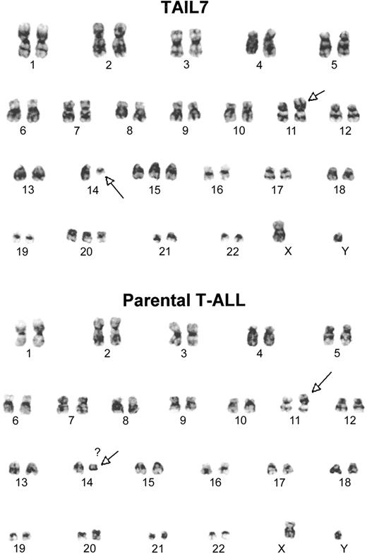Figure 1. TAIL7 cells and their parental primary leukemia cells share a common karyotype. Cytogenetic analysis was performed by using a standard G-banding technique. The t(11;14)(p13;q11) was the only clonal chromosomal abnormality consistently detected in all metaphases.