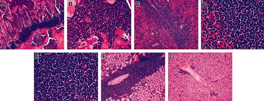 Figure 4. TAIL7 cells engraft NOD/SCID mice and are tumorigenic. Viable TAIL7 cells were transplanted into NOD/SCID mice (5 × 106 cells/animal). Mice were killed when moribund, and the indicated organs were collected for histological analysis. Bone marrow; original magnification × 10 (A) and × 40 (B). Spleen; original magnification × 10 (C) and × 40 (D). (E) Lymph node; original magnification, × 40. (F) Kidney; original magnification, × 10. (G) Liver; original magnification, × 10.