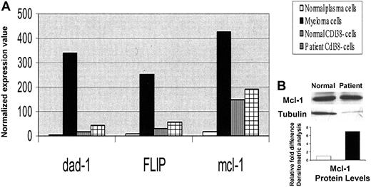 Figure 2. Increased antiapoptotic gene expression in MM cells versus healthy twin PCs. (A) Normalized expression values from gene chip Hu95av2 for antiapoptotic genes dad-1, FLIP, and mcl-1 gene transcripts in CD138+ and CD138– cells from BM from the patient with MM and the healthy twin. (B) Cell lysates were prepared from MM cells and normal twin PCs, resolved by 10% SDS-PAGE, transferred onto nitrocellulose membrane, and probed with anti–mcl-1 and anti-tubulin Abs. Blots were developed by enhanced chemiluminesence, and relative protein expression in patient MM cells compared with normal twin PCs was calculated using densitometry.