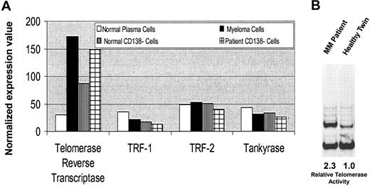 Figure 3. Telomerase expression in MM cells versus healthy twin PCs. (A) Normalized expression values from gene chip Hu95av2 for telomerase and other telomere-related genes in CD138+ and CD138– cells from BM from the patient with MM and the healthy twin. (B) Telomerase activity was measured using the TRAPeze telomerase detection kit. Cell lysates from patient MM cells and normal twin PCs following PCR amplification were electrophoresed on 12% nondenaturing polyacrylamide gel and stained with SYBR green I. Telomerase activity is determined by the ratio of the entire telomerase ladder to that of the internal control using densitometric analysis.