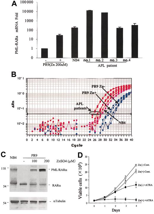 Figure 1. PML-RARα mRNA induction in U937/PR9 cells and expression levels in primary APL cells. (A) TaqMan RT-PCR analysis showing the induction of PML-RARα mRNA expression in U937/PR9 cells treated with 200 μM ZnSO4 for 24 hours and the levels of PML-RARα mRNA in primary APL cells. PML-RARα mRNA expression of each sample was normalized to β2-microglobulin. PR9 cells without ZnSO4 were used as calibrators (PML-RARα mRNA level in PR9 cells without ZnSO4 = 1). APL cell line NB4 was used as a reference. (B) Amplification plot of PML-RARα cDNA expression in PR9 cells following ZnSO4 treatment in NB4 and primary APL cells. Blue lines indicate PR9; magenta lines, NB4; and red lines, primary APL cells. (C) Western blot showing the induction of PML-RARα protein expression in U937/PR9 cells treated with 100 μM or 200 μM ZnSO4 and in NB4 cells. (D) PR9 cells exposed to ZnSO4 (200 μM) were cultured in medium with or without 1 μM ATRA, and growth curves were constructed. Live cells were counted daily using the trypan blue exclusion method. Graphs represent the mean ± SD of the results obtained from 3 independent experiments. In the absence of ZnSO4, PR9 cells were cultured without ATRA (□) or with ATRA (▪). In the presence of ZnSO4, PR9 cells were cultured without ATRA (○) or with ATRA (•).