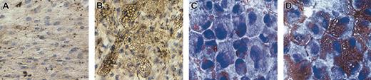 Figure 3. Immunocytochemical staining for leptin before and after induction of adipocyte differentiation of MSCs. Representative immunocytochemistry staining results for leptin expression in MSCs. (A) MSC monolayers before adipocyte differentiation culture and (B) after 14 days of adipocyte differentiation culture (original magnification, × 200). (C) Trypsinized MSC before adipocyte differentiation culture and (D) after 14 days of adipocyte differentiation culture (original magnification, × 400). After adipocyte differentiation, staining for leptin was more intense in cultured MSCs.