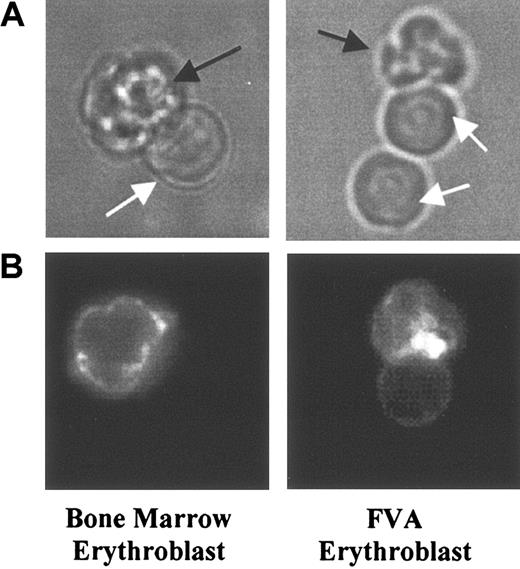 Figure 1. Micrographs of PE-Ter119–labeled enucleating erythroblasts from mouse bone marrow and FVA cell culture. (A) Bright field illumination of enucleating erythroblasts, including nascent reticulocytes (black arrows) and extruding nuclei (white arrows). (B) Fluorescence microscopy of enucleating erythroblasts. Fluorescent intensities in nascent reticulocytes were greater than those in extruding nuclei, which indicated that GPA predominately partitions to reticulocytes during erythroblast enucleation. For scale reference, the diameter of the nucleus is 4.4 μm.