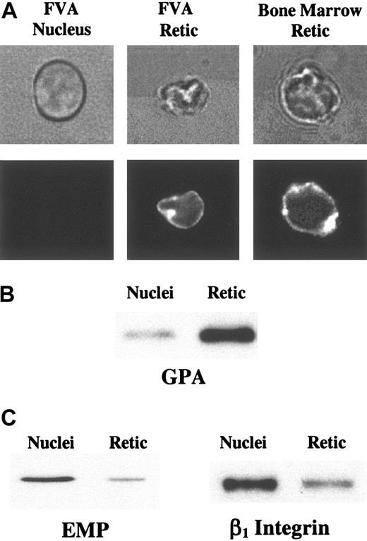 Figure 2. Micrographs and Western blots of extruded nuclei and reticulocytes. (A) Bright field illumination (top panels) and fluorescence microscopy (bottom panels) of an extruded nucleus from FVA cell culture, a PE-Ter119–labeled reticulocyte from FVA cell culture, and a PE-Ter119–labeled reticulocyte from bone marrow. Retic indicates reticulocyte. For scale reference, the diameter of the nucleus is 4.4 μm. (B) Nuclear and reticulocyte proteins from 5 × 105 nuclei and 5 × 105 reticulocytes from FVA cell cultures, separated on a SDS-PAGE gel, were immunoblotted using monoclonal antibody Ter119. Results from both fluorescence microscopy and Western blot analysis showed that GPA sorted predominantly to reticulocytes. (C) Nuclear and reticulocyte proteins from 5 × 105 nuclei and 5 × 105 reticulocytes from FVA cell cultures, separated on a SDS-PAGE gel, were immunoblotted using monoclonal antibodies specific for EMP or β1 integrin subunit. Both EMP and β1 partitioned predominantly to nuclei.