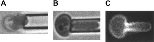 Figure 3. Micrographs of a micropipette-aspirated, PE-Ter119–labeled reticulocyte. (A) Bright field illumination of a micropipette ready to aspirate a multilobular, young reticulocyte. (B) Bright field illumination of aspirated reticulocyte showing that the multilobular structure of the reticulocyte membrane could be smoothed out by aspirating the cell into the micropipette. (C) Fluorescence microscopy of the aspirated PE-Ter119–labeled reticulocyte showed a density gradient of GPA along the deformation projection. For scale reference, the diameter of the micropipette is 1.5 μm.