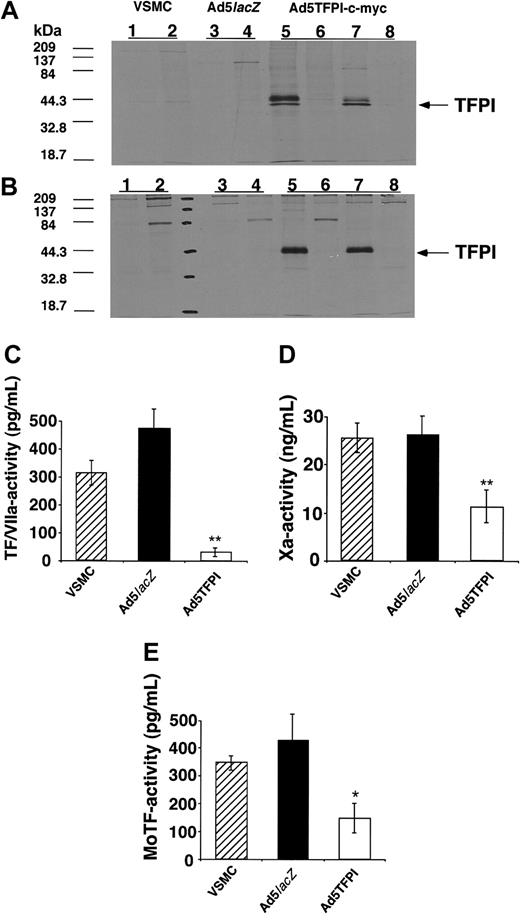 Figure 4. TFPI overexpressed in VSMCs inhibits monocyte TF activity. Immunoprecipitation of cellular extracts (A) or conditioned supernatant fluid (B) from 35S-labeled untreated (VSMC), control virus–transfected (Ad5lacZ), or TFPI-transfected (Ad5TFPI–c-myc) rabbit VSMCs with either control antibody (lanes 2, 4, 6, and 8), antibody specific for human TFPI (lanes 1, 3, and 5), or the c-myc epitope (lane 7). Inhibition of factor Xa activity (C), TF/VIIa-complex activity on factor X (D), and of LPS-induced U937 monocyte TF activity (E) by untreated (▨), Ad5lacZ-transfected (▪), and Ad5TFPI–c-myc–transfected (□) rabbit VSMCs determined by chromogenic assay. Data are expressed as mean ± SD; *P < .01, **P < .001.