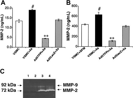 Figure 6. Inhibition of Xa-induced MMP-2 by TFPI in VSMCs. Cell-associated (A) and secreted (B) MMP-2 expression was determined by immunoassay in untreated (□) and factor Xa–stimulated, untransfected (▪) VSMCs, and Ad5TFPI-transfected (▧) and Ad5lacZ-transfected (▦) VSMCs. Data are mean ± SEM of 3 experiments. #P < .05, **P < .001. MMP-2 activity of untransfected (lanes 2 and 4) and TFPI-transfected (lanes 1 and 3) rabbit VSMCs was determined after stimulation with factor Xa (lanes 3-4) by gelatin zymography (C).