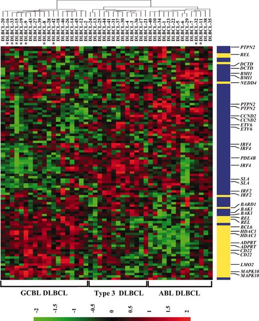 Figure 1. Clustering of DLBCL into GCBL, ABL, and type 3 DLBCL. The 46 DLBCLs were hierarchically clustered using the average linkage method for 99 probe pair sets that represented 62 genes of the 100 reported to distinguish GCBL/ABL DLBCL at the significance level of P < .001.22 Of the 62 genes, 23 (31 probe pair sets, yellow) were represented within the GCBL DLBCL expression signature and 39 (68 probe pair sets, blue) within the ABL DLBCL expression signature. Select transcripts are listed, with a full list given in Additional Data B. Red indicates high expression and green, low expression, with the color scale at the bottom showing the relative expression in standard deviations from the mean. *Specimens with t(14;18)(q32;q21) translocation.