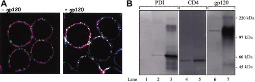 Figure 7. PDI colocalizes and is associated with CD4 and CXCR4 in the presence of gp120. (A) Sup T-1 cells were attached to poly-L-lysine slide and treated in the presence (right panel) or absence of soluble gp120 IIIB (left panel). Cells were then fixed in 2% paraformaldehyde and reacted with anti-CD4 rat MAb, anti-PDI rabbit PAb, and anti-CXCR4 mouse MAb. Subsequently, cells were incubated with secondary antirat conjugated with Alexa Fluor 647, antirabbit Cy2, and antimouse Alexa Fluor 555 Abs. Cells were mounted in Fluoromount-G and analyzed by confocal microscopy. PDI is shown as green, CXCR4 is shown as red, and CD4 is shown as blue; white indicates regions of triple, PDI/CD4/CXCR4 colocalization. The data shown are representative of the staining detected in more than 70% of analyzed cells. Original magnification, × 63. (B) HOS-CD4+/CXCR4+ cells were pretreated with gp120 IIIB followed by lysis and coimmunoprecipitation with the anti-CXCR4 MAb, 4G10. Lanes 1 to 3 were probed with anti-PDI PAb, lanes 4 and 5 with an anti-CD4 rabbit serum, and lanes 6 and 7 with an anti-gp120 rabbit serum. A negative control was prepared from HOS-CD4+/CXCR4+ cell lysate not exposed to 4G10 MAb (lane 1), lane 2 represents PDI coimmunoprecipitated from HOS-CD4+/CXCR4+ cells in the presence of anti-CXCR4 Ab, and lane 3 represents soluble PDI included as a control for band identity. Lane 4 represents CD4 coimmunoprecipitated from HOS-CD4+/CXCR4+ cells in the presence of anti-CXCR4 Ab. Lane 5 is a positive CD4 control prepared from HOS-CD4+/CXCR4+ cell lysate by adding the anti-CD4 MAb, Leu3A (3 μg/5 × 106 cells) and subsequent precipitation with protein G beads. Lane 6 indicates gp120 coimmunoprecipitation from HOS-CD4+/CXCR4+ cells in the presence of anti-CXCR4 Ab; lane 7 represents soluble gp120 included as a control for band identity.