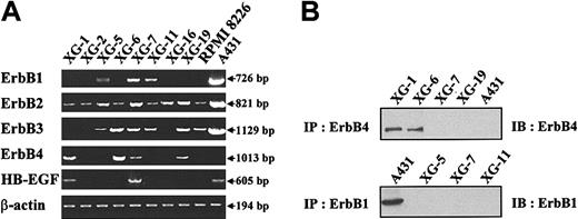 Figure 1. Expression of EGF receptor family members in myeloma cell lines. (A) ErbB1, ErbB2, ErbB3, ErbB4, and HB-EGF gene expression was assayed with RT-PCR in 9 myeloma cell lines. The A431 epidermoid carcinoma cell line was used as a control. Amplification of β actin shows the equivalence of the cDNA loading and amplification. Results are from one experiment representative of 3. (B) Myeloma cells or A431 cells were lysed and the lysates were immunoprecipitated with the H4.72.8 anti-ErbB4 or the LA-22 anti-ErbB1 antibody. The precipitated material was separated on a 7.5% SDS-PAGE and analyzed by Western blotting with a second anti-ErbB antibody (anti-ErbB4, clone C-18, or anti-ErbB1, clone LA-1). Results are of one experiment representative of 3.