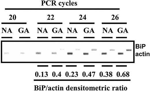 Figure 4. Induction of BiP transcripts by GA. CLL cells were incubated for 8 hours in the absence (NA) or presence (GA) of 100 nM GA. RNA was prepared and analyzed by reverse transcriptase–PCR for actin and BiP transcripts. Following amplification for the indicated cycles, products were fractionated on an agarose gel, stained with ethidium bromide, and visualized using a UV transilluminator.